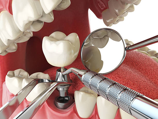Best Weekend Emergency Dentist in Wellington, TX